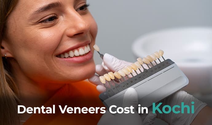 Dental Veneers Cost in Kochi
