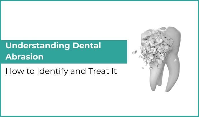 Understanding Dental Abrasion – How to Identify and Treat It
