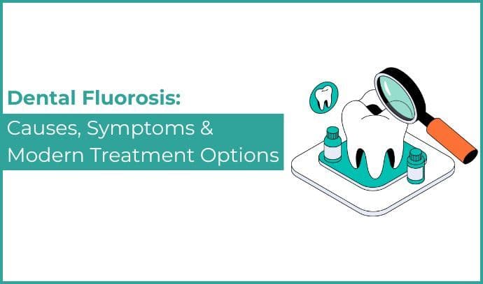 Dental Fluorosis – Causes, Symptoms & Modern Treatment Options