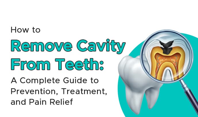 How to Remove Cavity from Teeth: A Complete Guide to Prevention, Treatment, and Pain Relief