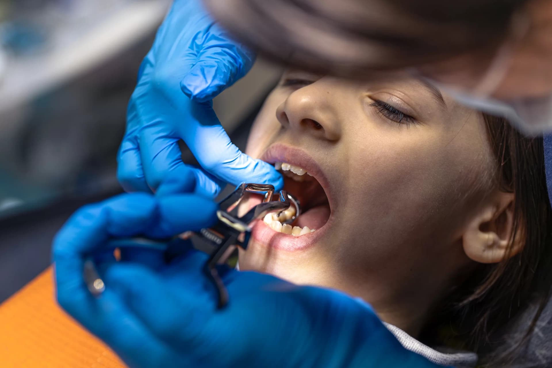 Dental laser aftercare