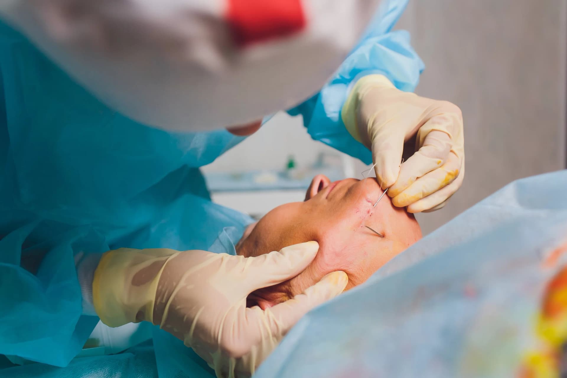 Dental laser treatment