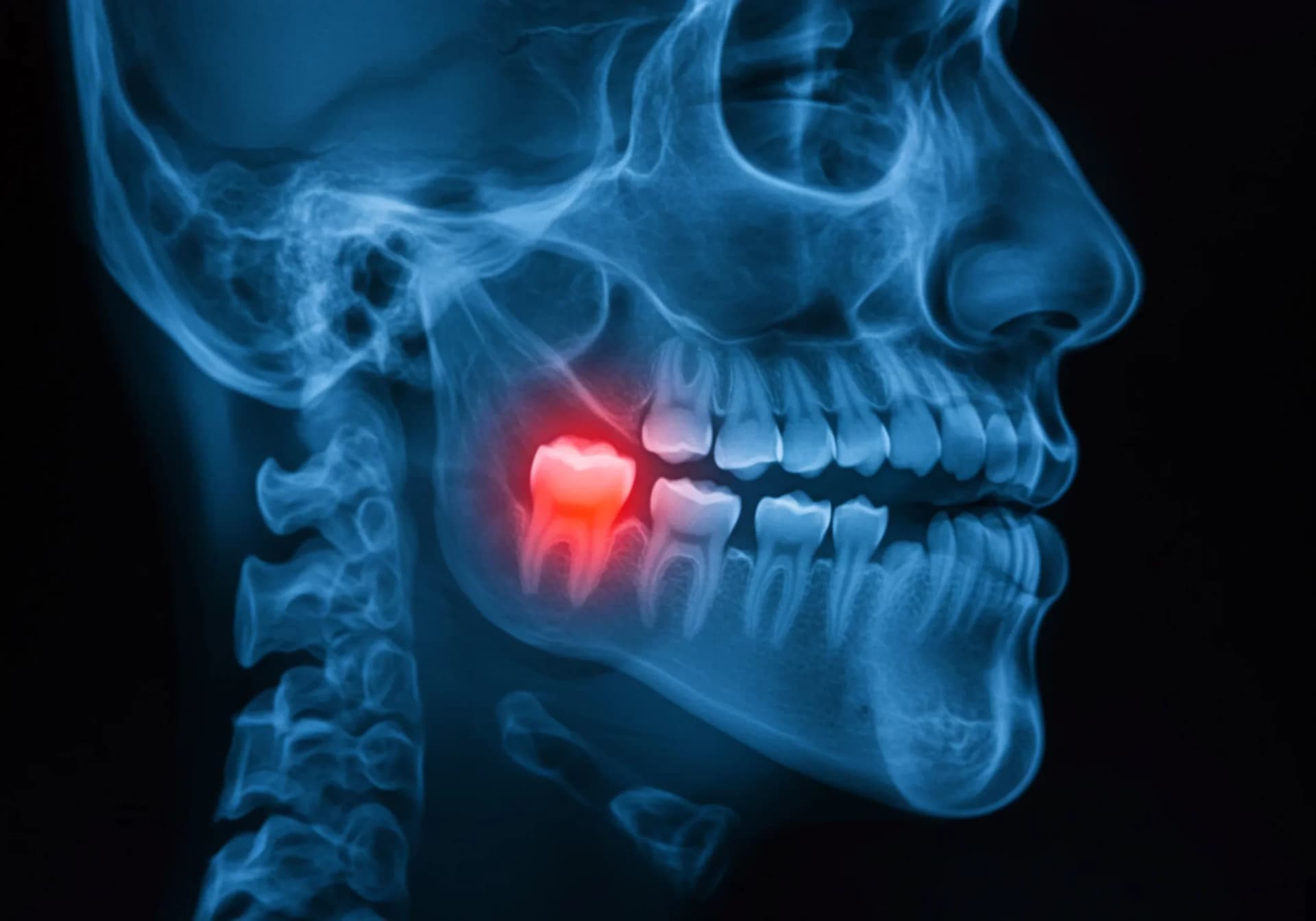Maxillofacial & Orthognathic surgery