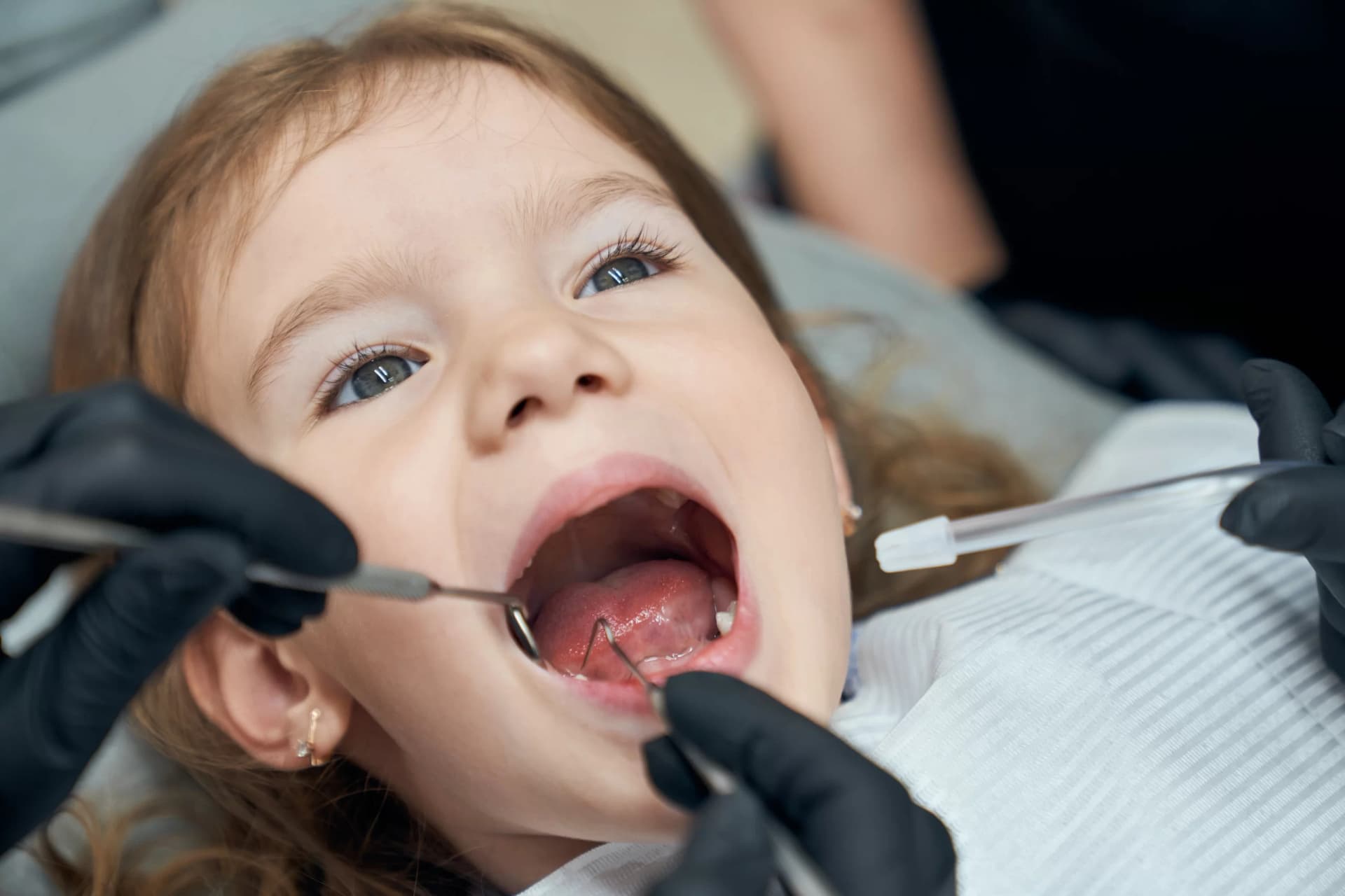 Dental laser treatment