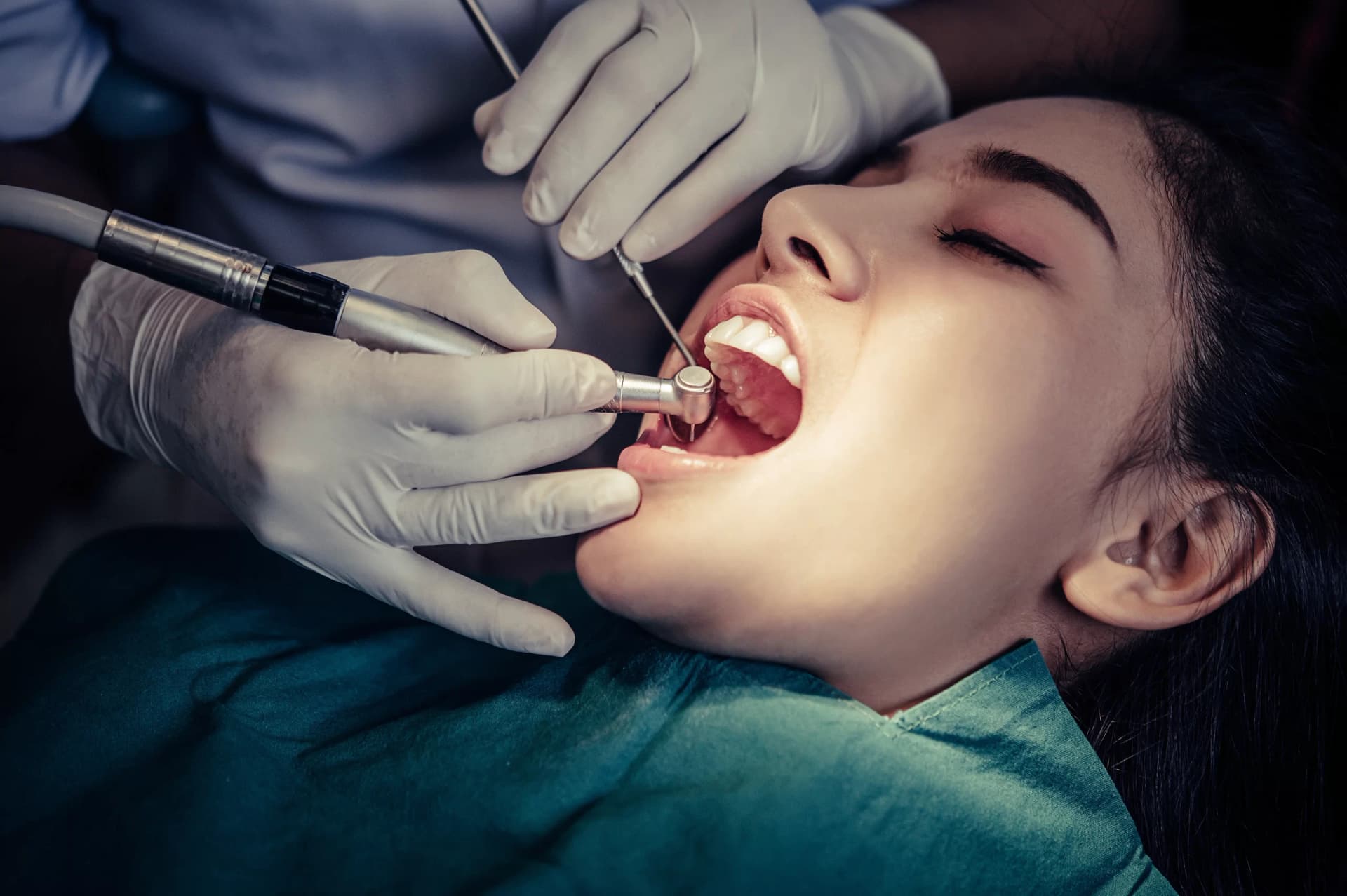 Dental laser treatment