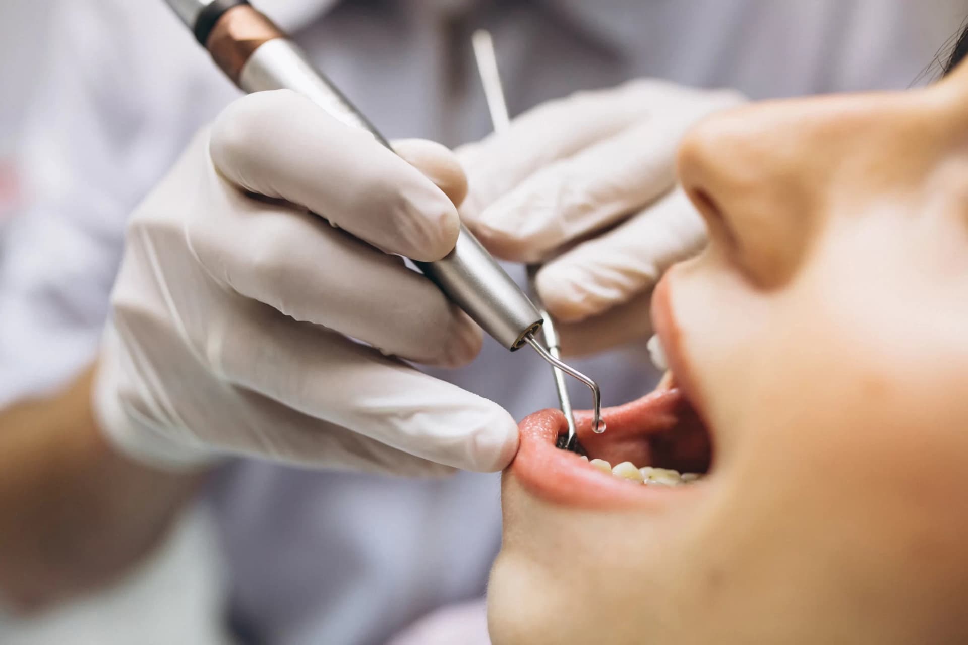 Dental laser treatment