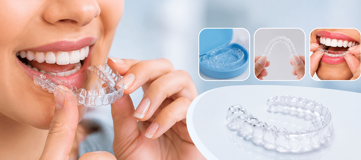 Dental treatment at Elite Dental Studio