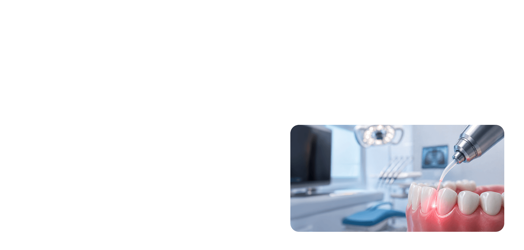 Laser Dental Clinic in Coimbatore procedure