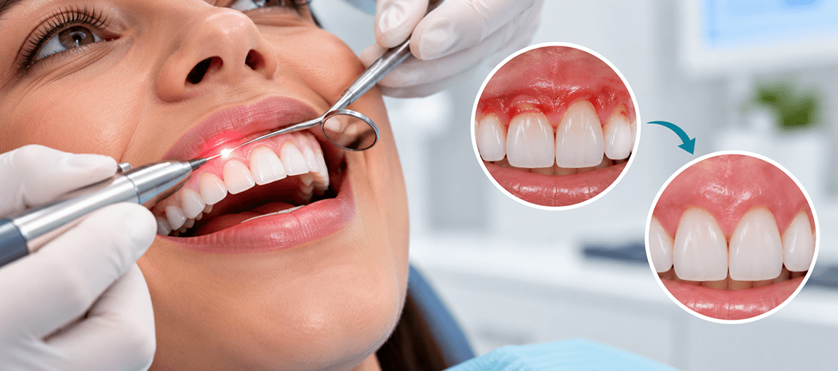 Dental treatment at Elite Dental Studio