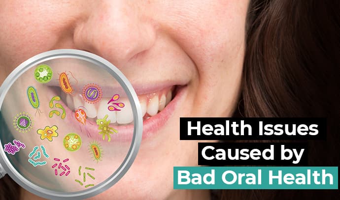 Bad oral health