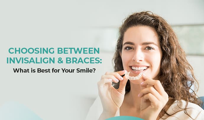 choosing between invisalign and braces what is best for your smile