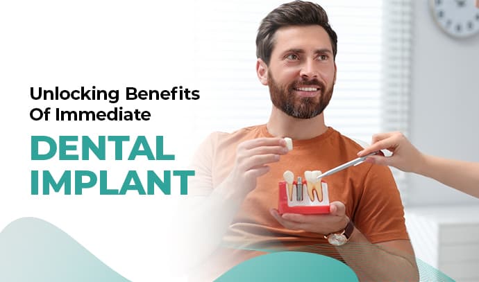 Dental Implant
