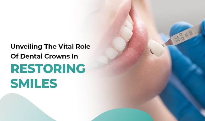 unveiling the vital role of dental crowns in restoring smiles