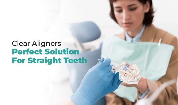 clear aligners perfect solution for straight teeth