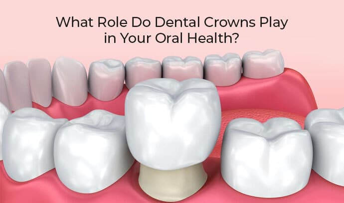 what role do dental crowns play in your oral Health