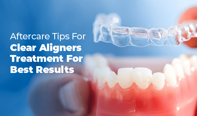 aftercare tips for clear aligners treatment for best results
