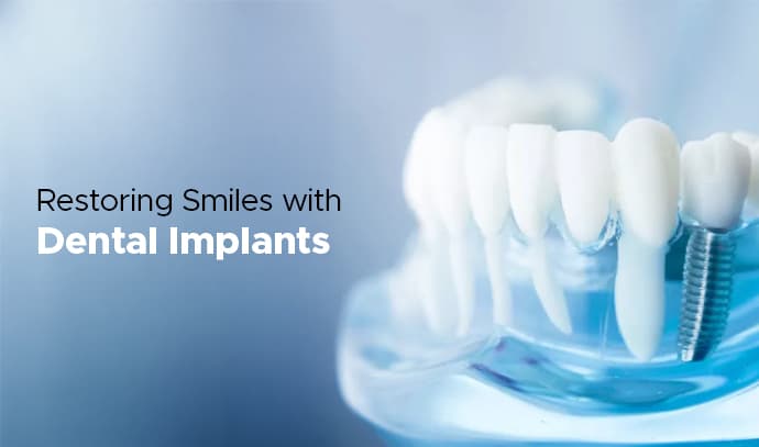 restoring smiles with dental implants