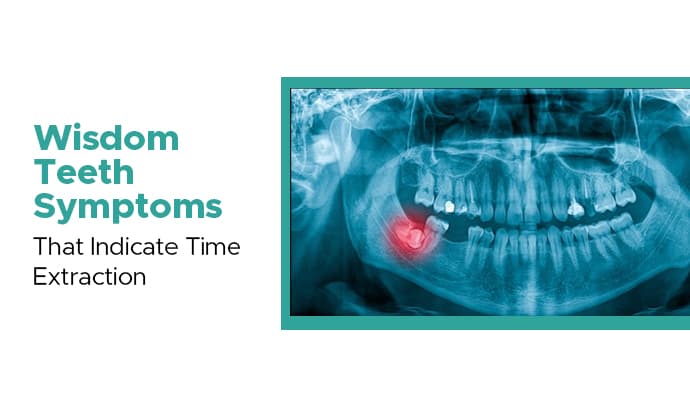 wisdom teeth symptoms that indicate time extraction