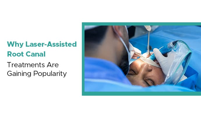 why laser-assisted root canal treatments are gaining popularity