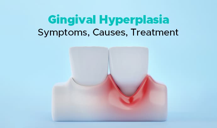 gingival hyperplasia