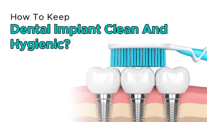 how-to-keep-dental-implant-clean-and-hygienic