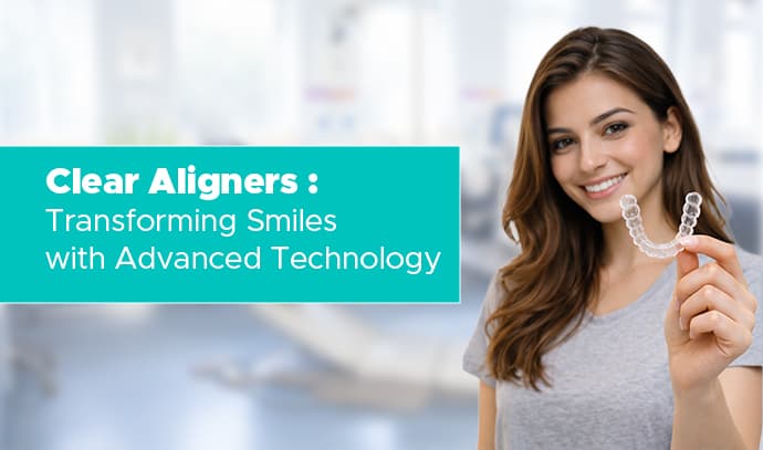 Clear Aligners: Transforming Smiles with Advanced Technology