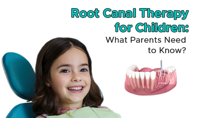 root-canal-therapy-for-children--what-parents-need-to-know