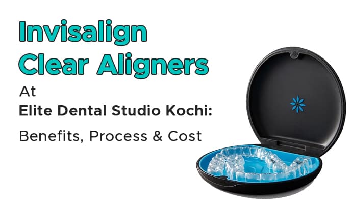 invisalign in kochi