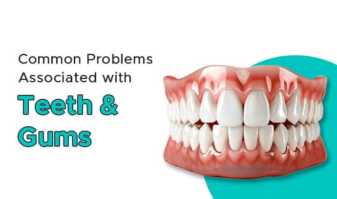 common-problems-associated-with-teeth-and-gums