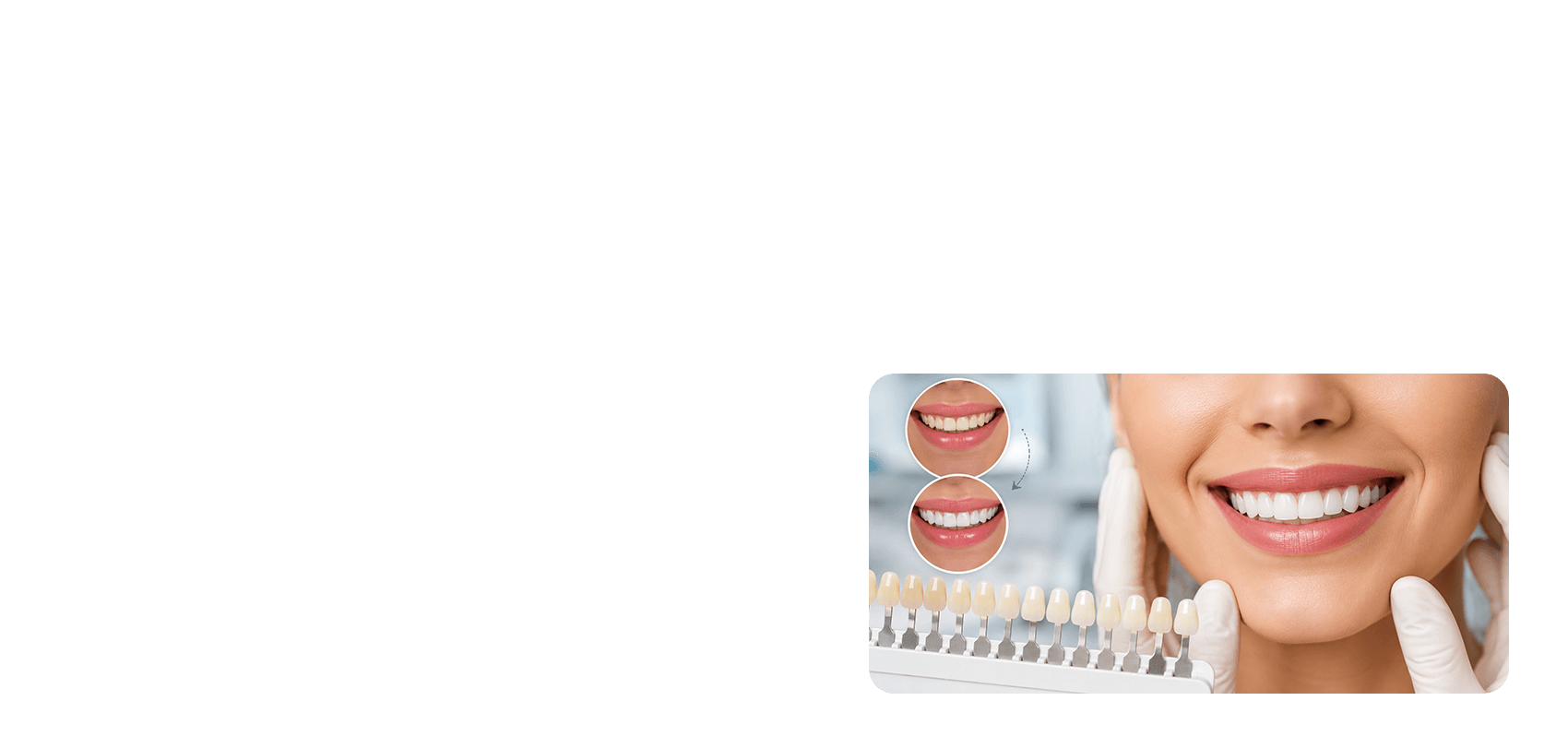 Cosmetic Dentist in Coimbatore procedure