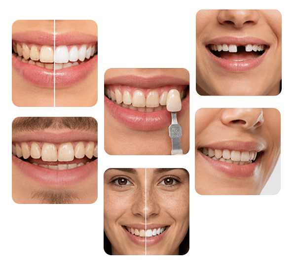 Cosmetic Dentist in Coimbatore treatment examples