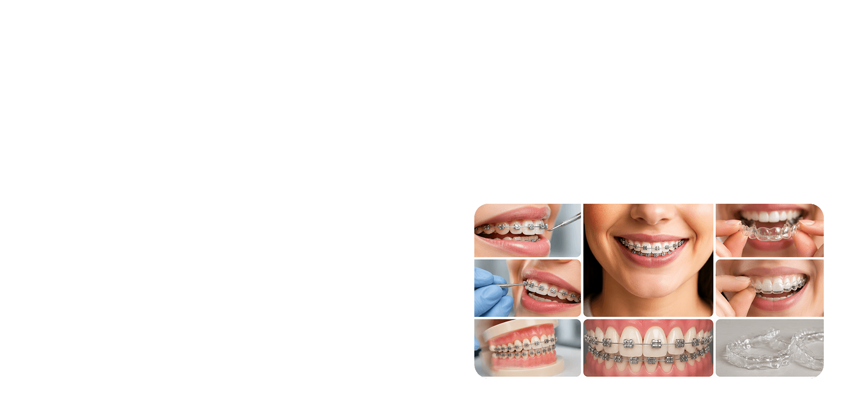 Orthodontics procedure