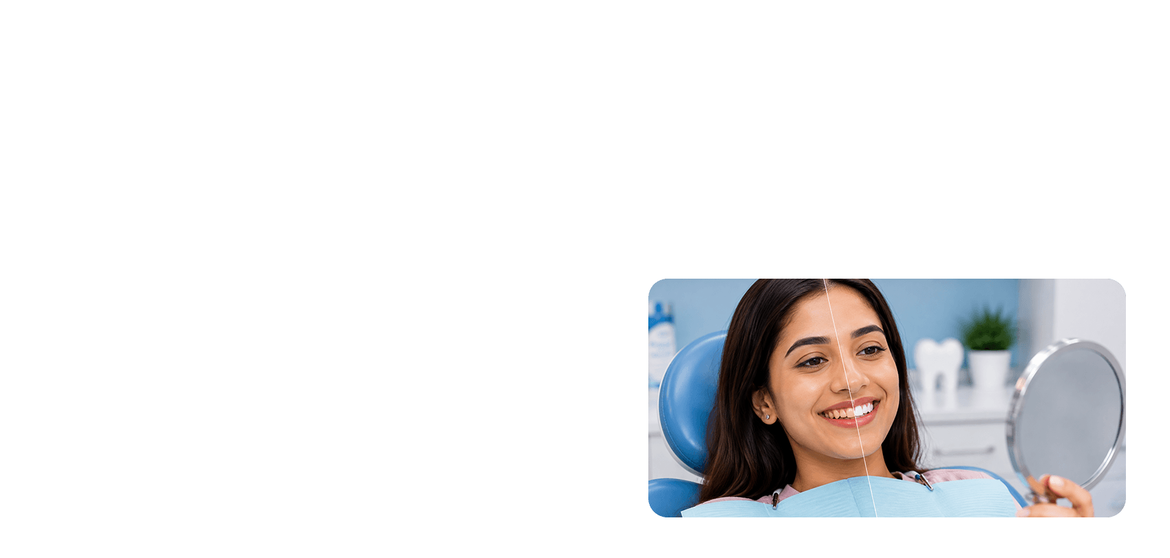 Teeth Whitening in Coimbatore procedure