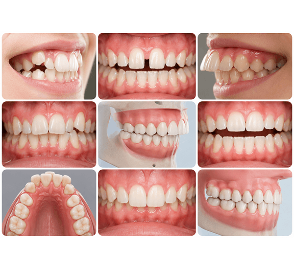 Dental laser aftercare