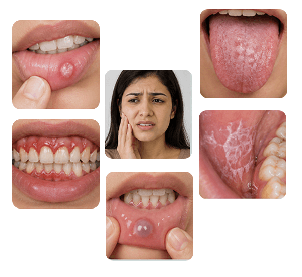 Oral Medicine and Radiology treatment examples