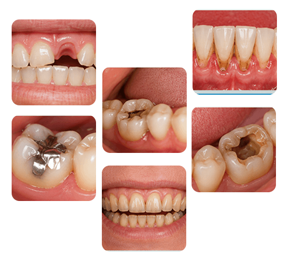 Restorative Dentistry treatment examples