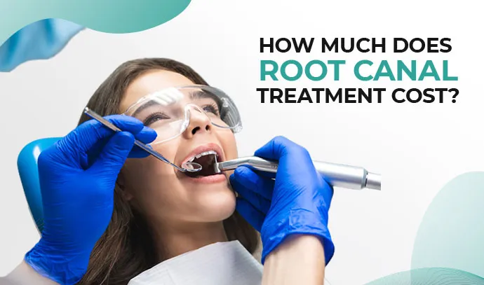 root canal treatment cost