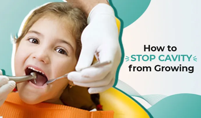stop cavity from growing