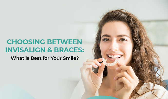 Choosing Between Invisalign and Braces: What is Best for Your Smile?