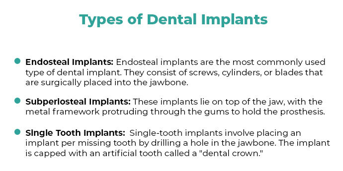all about different types of dental implants