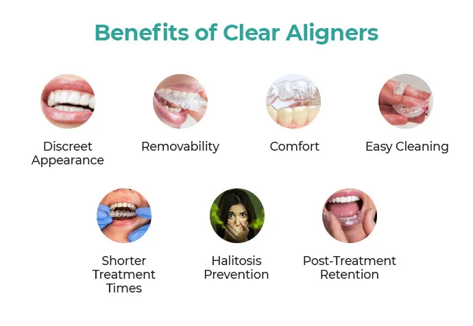 benefits of clear aligners