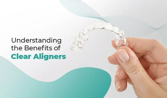 clean aligners