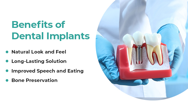 unlocking benefits of immediate dental implant