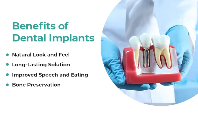 unlocking benefits of immediate dental implant