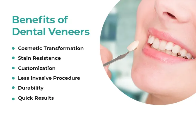 benefits of dental veneers