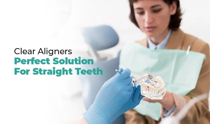 clear aligners perfect solution for straight teeth