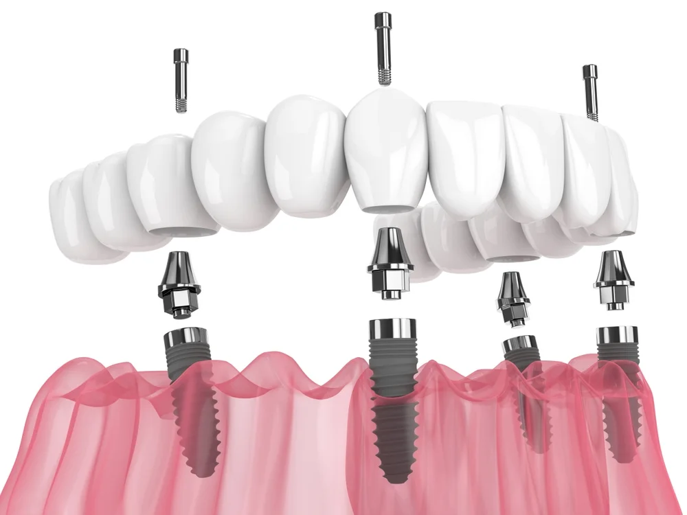 Elite_Dental_Clinic