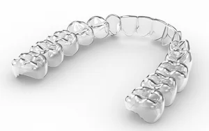 Clear Aligners Treatment in Kannur