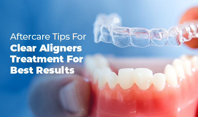 Aftercare Tips For Clear Aligners Treatment For Best Results
