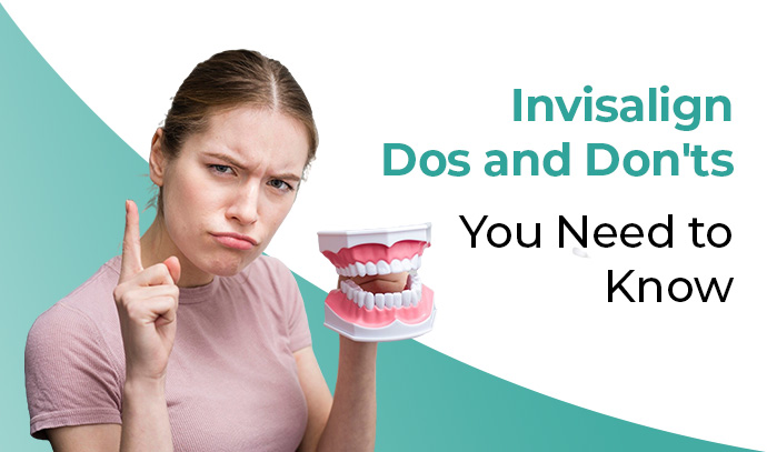 Invisalign Dos and Don’ts You Need to Know